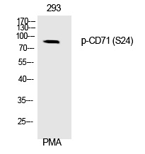 Phospho-Transferrin Receptor (Ser24) Antibody in Western Blot (WB)
