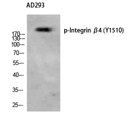 Phospho-CD104 (Tyr1510) Antibody in Western Blot (WB)