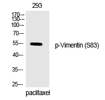 Phospho-Vimentin (Ser83) Antibody in Western Blot (WB)