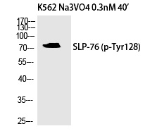 Phospho-SLP76 (Tyr128) Antibody in Western Blot (WB)