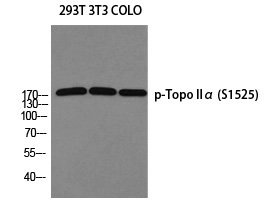 Phospho-TOP2A (Ser1525) Antibody in Western Blot (WB)