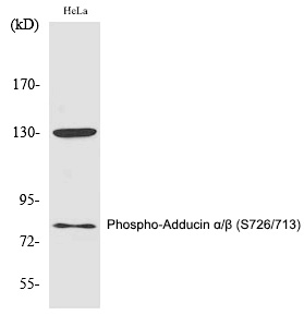 Phospho-ADD1/ADD2 (Ser726, Ser713) Antibody in Western Blot (WB)
