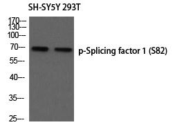 Phospho-SF1 (Ser82) Antibody in Western Blot (WB)