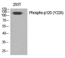 Phospho-delta Catenin (Tyr228) Antibody in Western Blot (WB)