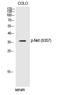 Phospho-ELK3 (Ser357) Antibody in Western Blot (WB)