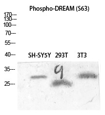 Phospho-KChIP3 (Ser63) Antibody in Western Blot (WB)