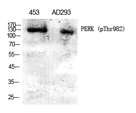 Phospho-PERK (Thr982) Antibody in Western Blot (WB)