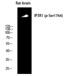 Phospho-IP3 Receptor 1 (Ser1764) Antibody in Western Blot (WB)