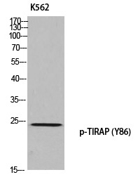 Phospho-TIRAP (Tyr86) Antibody in Western Blot (WB)