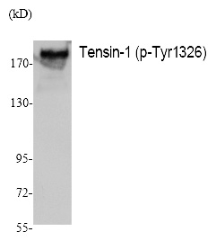 Phospho-Tensin 1 (Tyr1326) Antibody in Western Blot (WB)