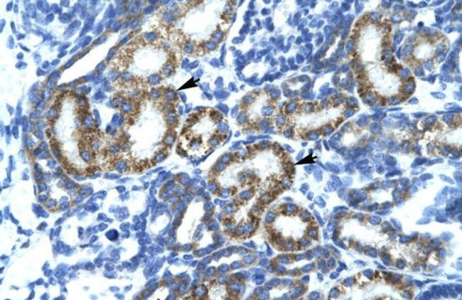FIZ1 Antibody in Immunohistochemistry (Paraffin) (IHC (P))