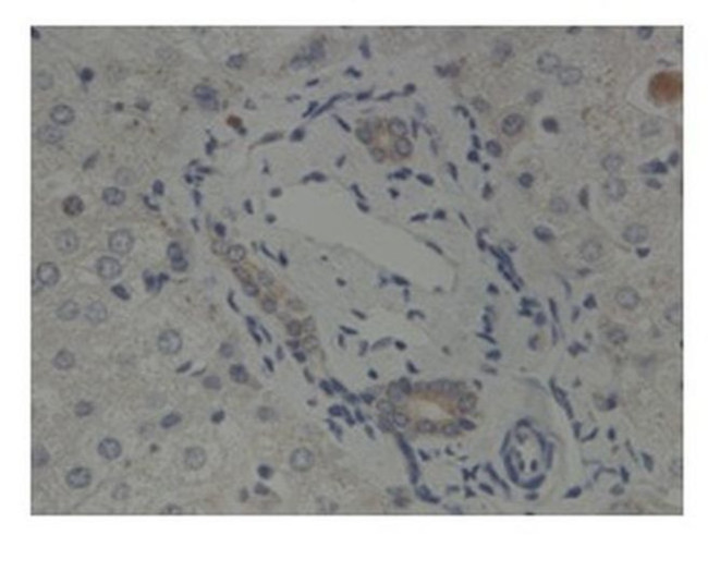 GLIS2 Antibody in Immunohistochemistry (IHC)