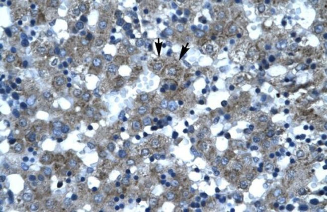 SPT3 Antibody in Immunohistochemistry (Paraffin) (IHC (P))