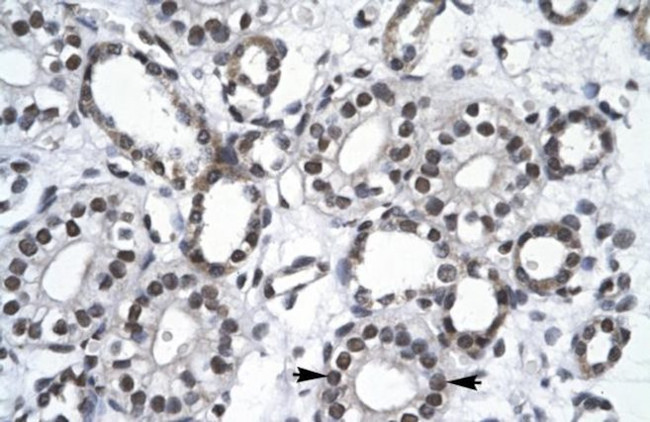 RBM10 Antibody in Immunohistochemistry (Paraffin) (IHC (P))