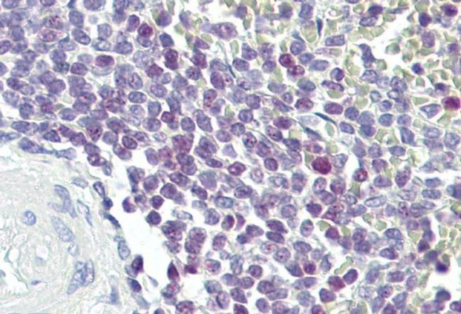 ELF1 Antibody in Immunohistochemistry (IHC)
