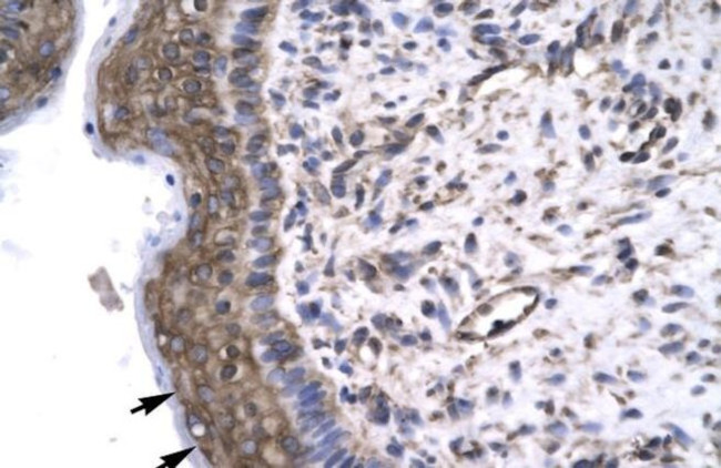 GTF2F2 Antibody in Immunohistochemistry (Paraffin) (IHC (P))
