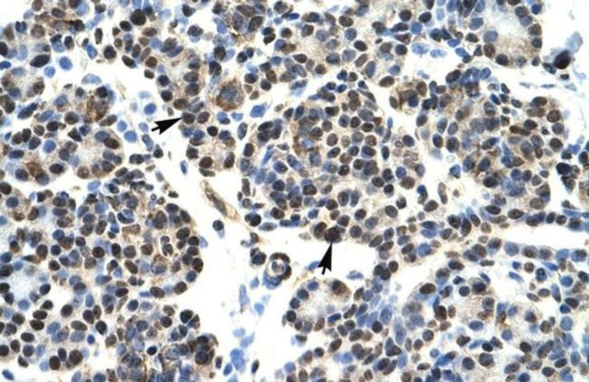 HOXB5 Antibody in Immunohistochemistry (IHC)
