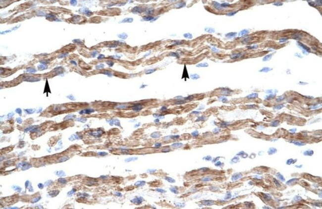 PQBP1 Antibody in Immunohistochemistry (IHC)