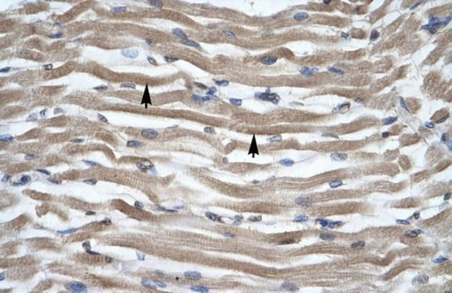 DLX2 Antibody in Immunohistochemistry (IHC)