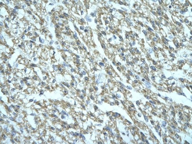 FGD1 Antibody in Immunohistochemistry (Paraffin) (IHC (P))