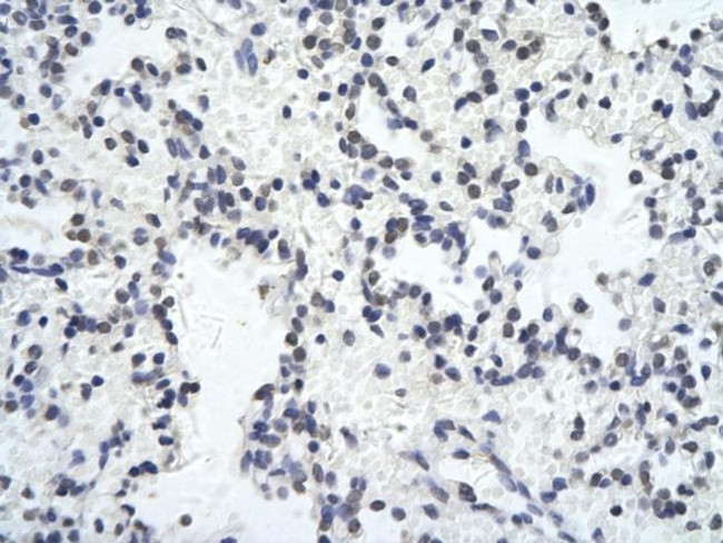 ZNF652 Antibody in Immunohistochemistry (Paraffin) (IHC (P))