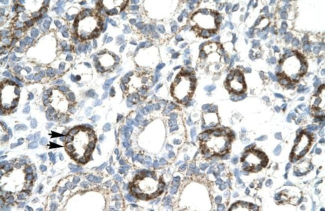FOXF2 Antibody in Immunohistochemistry (IHC)