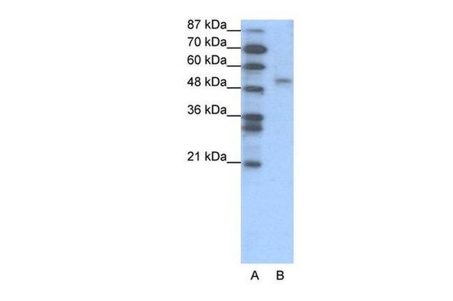 FOXD2 Antibody in Western Blot (WB)