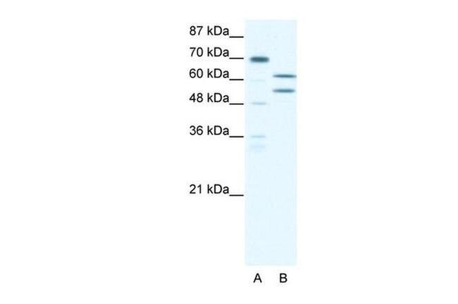ZNF297B Antibody in Western Blot (WB)