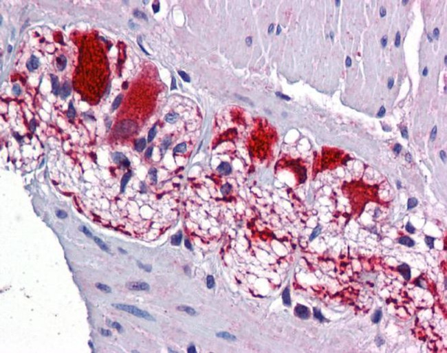 SSBP2 Antibody in Immunohistochemistry (Paraffin) (IHC (P))