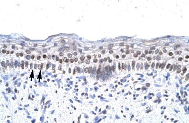 ZNF500 Antibody in Immunohistochemistry (IHC)