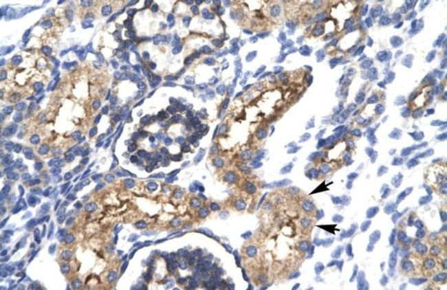 EHF Antibody in Immunohistochemistry (IHC)