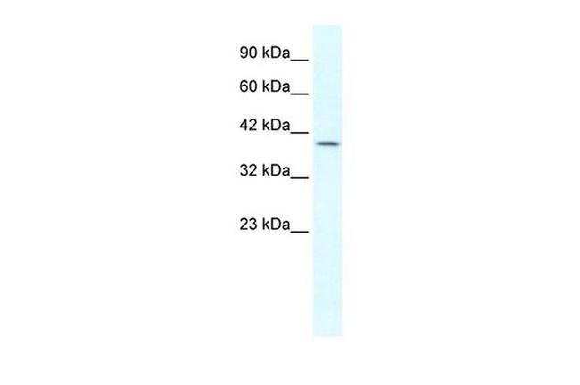 GBX2 Antibody in Western Blot (WB)