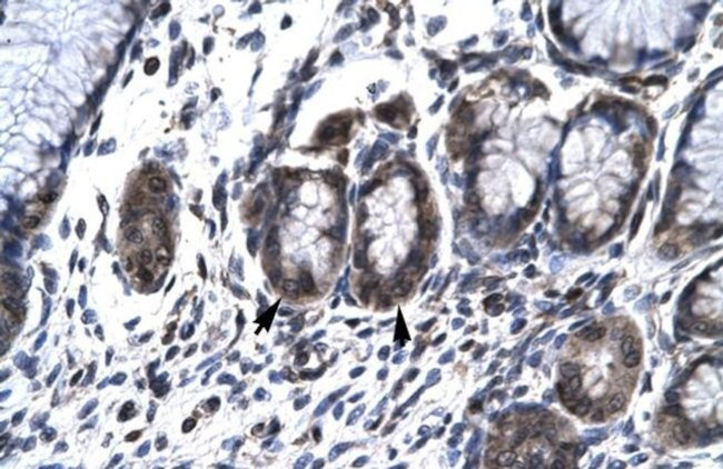 HCLS1 Antibody in Immunohistochemistry (Paraffin) (IHC (P))