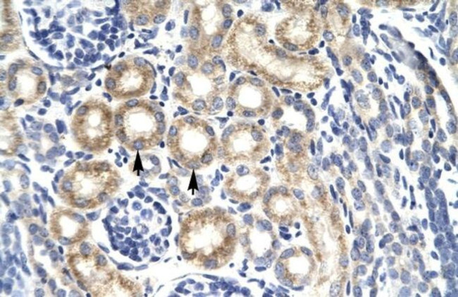 KChIP3 Antibody in Immunohistochemistry (IHC)