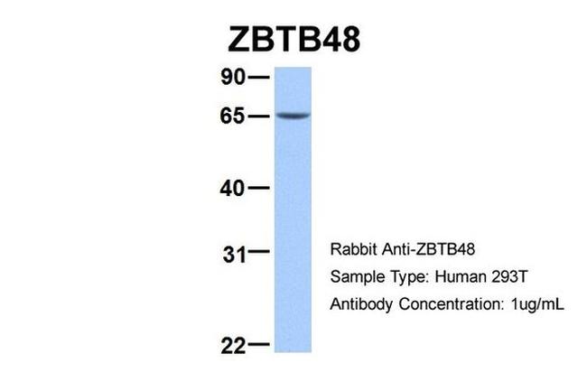 ZBTB48 Antibody in Western Blot (WB)
