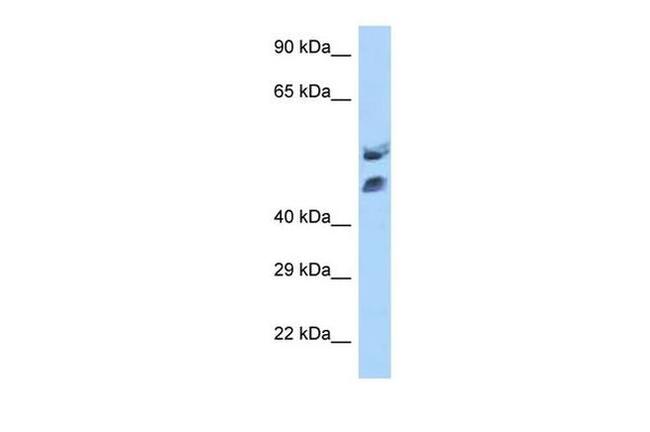 HOXA13 Antibody in Western Blot (WB)