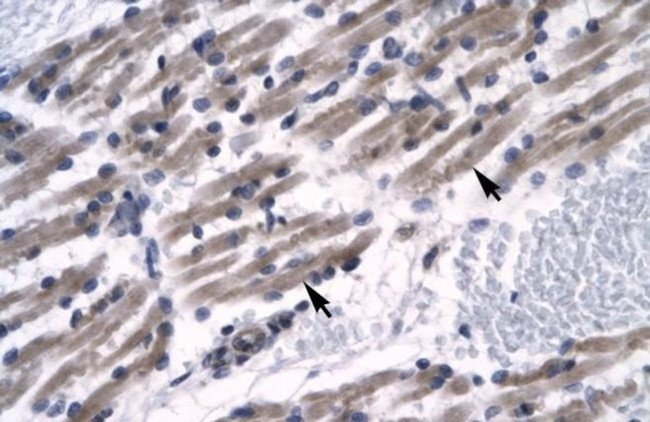 ZNF391 Antibody in Immunohistochemistry (IHC)