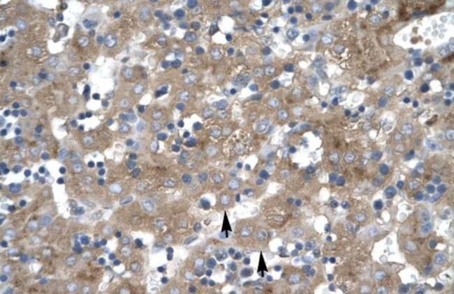 ZNF81 Antibody in Immunohistochemistry (IHC)