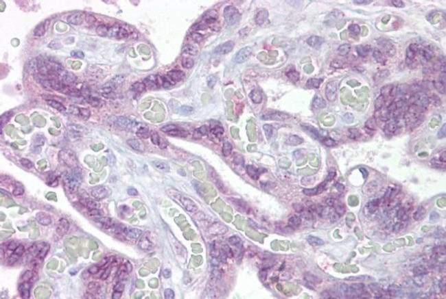 IRF6 Antibody in Immunohistochemistry (IHC)
