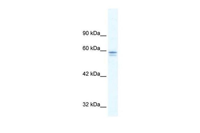 MTF1 Antibody in Western Blot (WB)