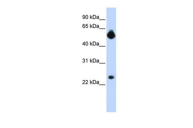NOTCH4 Antibody in Western Blot (WB)