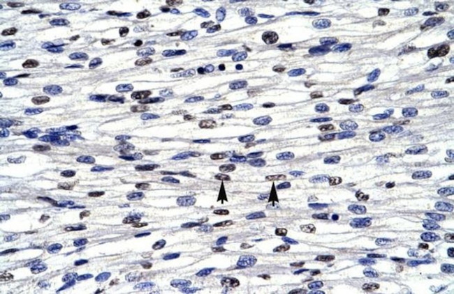 CGI-143 Antibody in Immunohistochemistry (IHC)