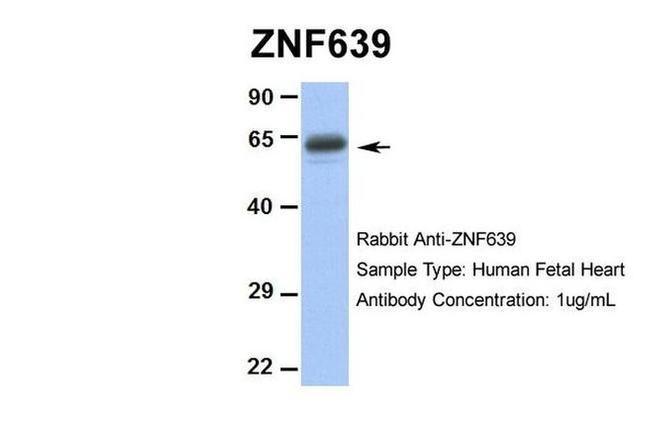 ZNF639 Antibody in Western Blot (WB)