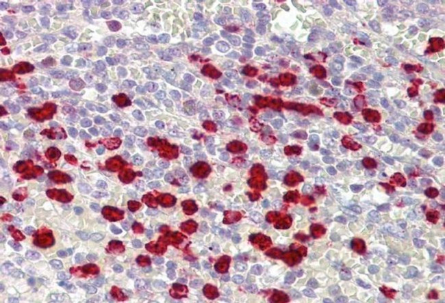 ZNF746 Antibody in Immunohistochemistry (IHC)