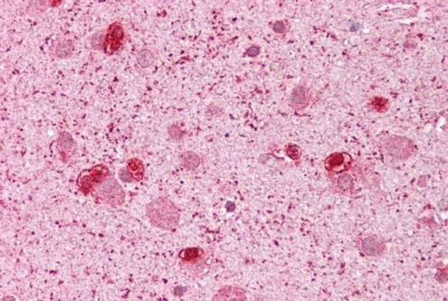 GSX2 Antibody in Immunohistochemistry (IHC)