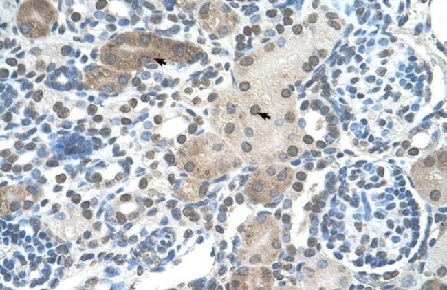 DLX2 Antibody in Immunohistochemistry (IHC)