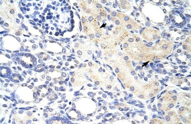 DLX3 Antibody in Immunohistochemistry (Paraffin) (IHC (P))