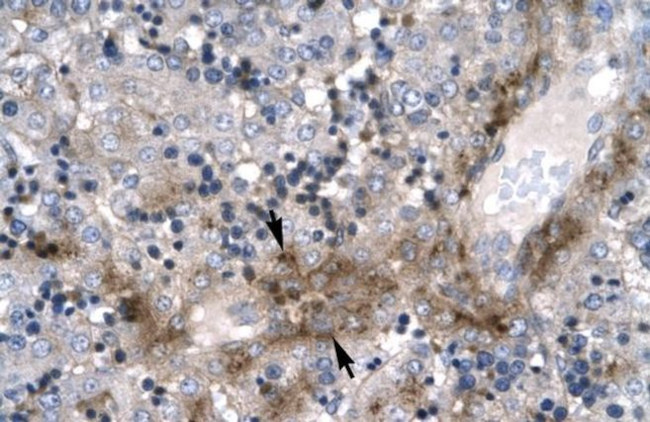 ZNF365 Antibody in Immunohistochemistry (Paraffin) (IHC (P))