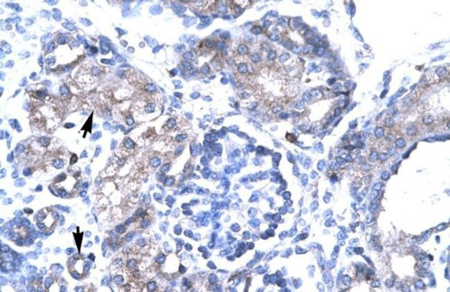 TBX19 Antibody in Immunohistochemistry (IHC)