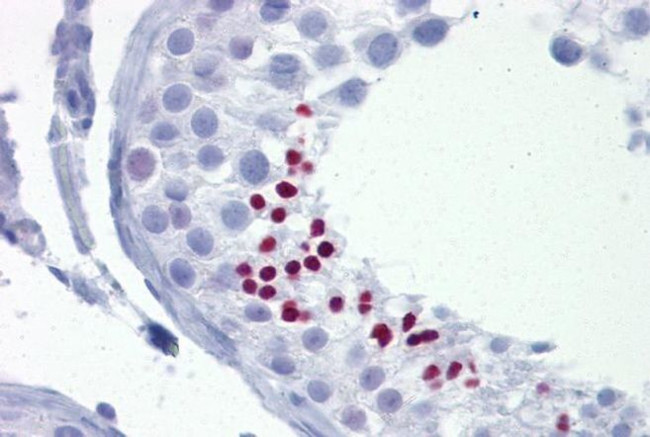 TLE4 Antibody in Immunohistochemistry (IHC)